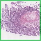 Duodenum - Histologie