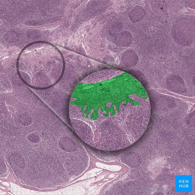 Sinus lymphatici medullares (Marksinus); Bild: 