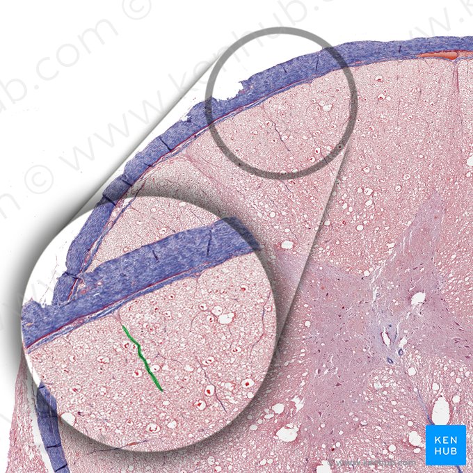 Septo mediano posterior da medula espinal (Septum medianus posterior medullae spinalis); Imagem: 