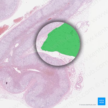 Textus adiposus periadrenalis (Periadrenales Fettgewebe); Bild: 