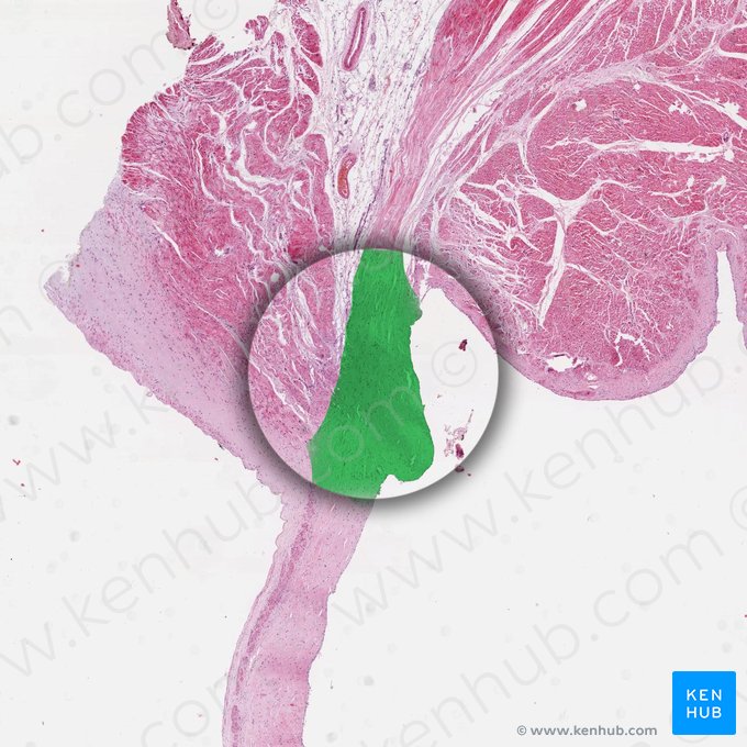 Anel fibroso (Anulus fibrosus); Imagem: 