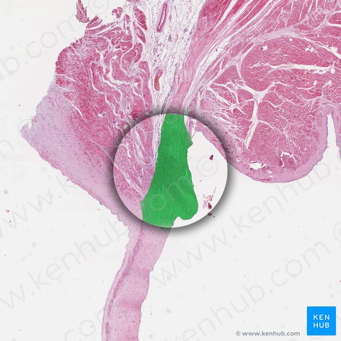 Anillo fibroso (Anulus fibrosus); Imagen: 