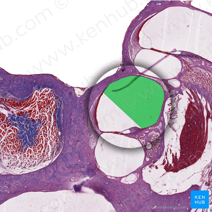 Rampa vestibular (Scala vestibuli); Imagen: 