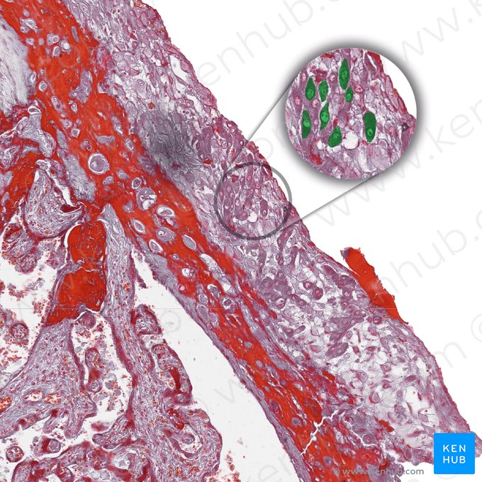 Trophoblastic ''X- Cells''; Image: 