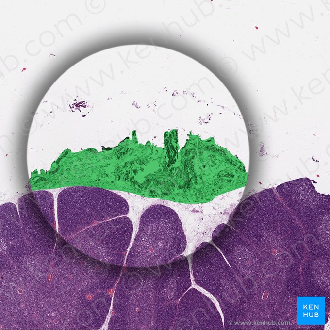 Efferent lymphatic vessel (Vas lymphaticum efferens); Image: 