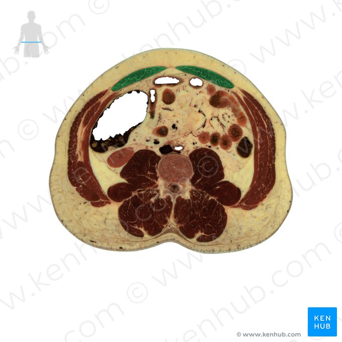 Musculus rectus abdominis (Gerader Bauchmuskel); Bild: National Library of Medicine