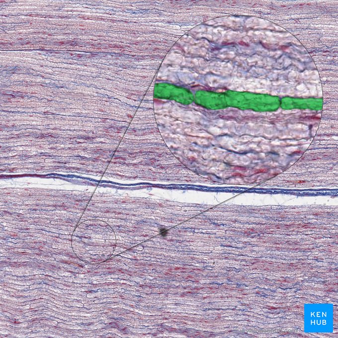 Spatium myelini (Heller Hof (ausgewaschenes Myelin)); Bild: 