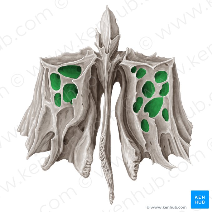 Células etmoidais (Cellulae ethmoidales); Imagem: Samantha Zimmerman