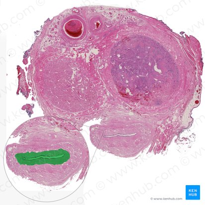 Uretra esponjosa (Pars spongiosa urethrae); Imagem: 