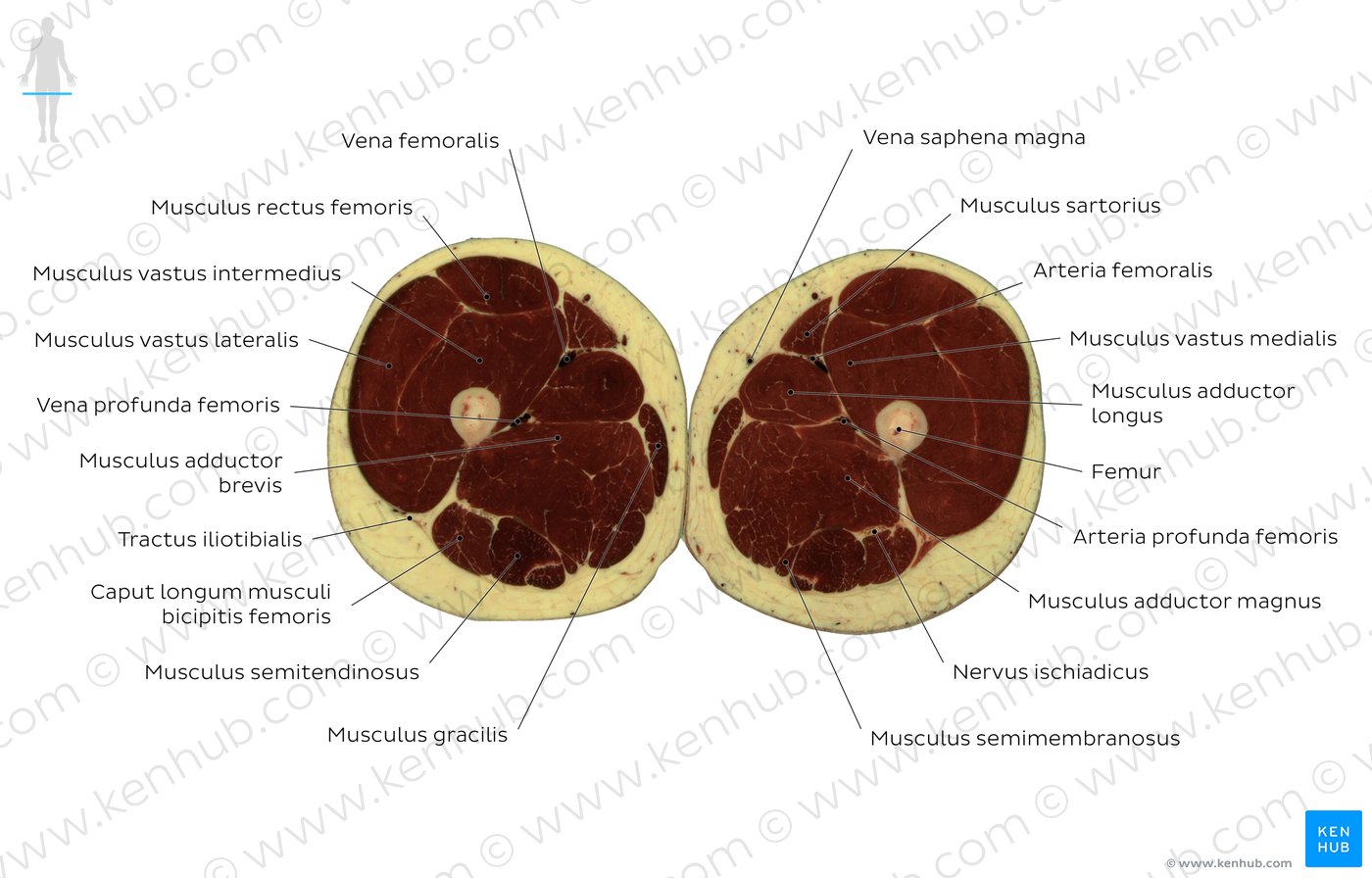 Schnittbild auf Höhe des M. adductor longus