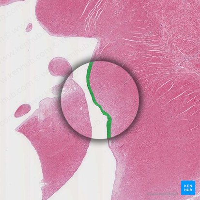 Endocardium (Endokard); Bild: 