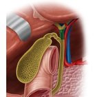 Common hepatic duct