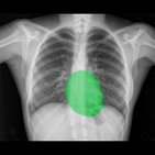 Schritt für Schritt zur Röntgen-Thorax-Befundung