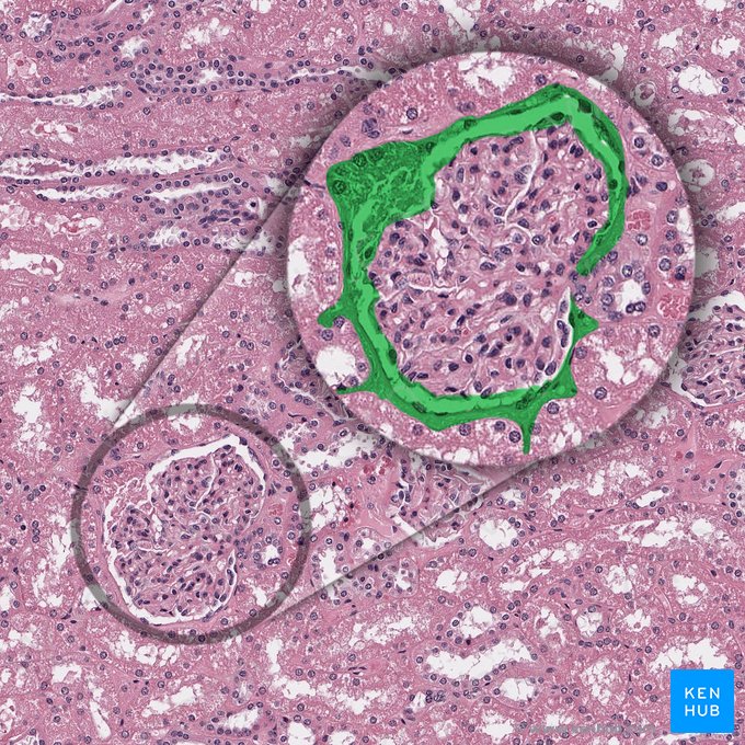 Cápsula de Bowman (Capsula glomerularis); Imagem: 