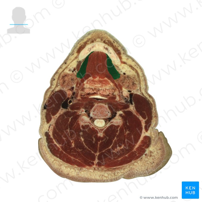 Musculus mylohyoideus (Unterkiefer-Zungenbein-Muskel); Bild: National Library of Medicine