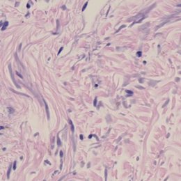 Dense connective tissue