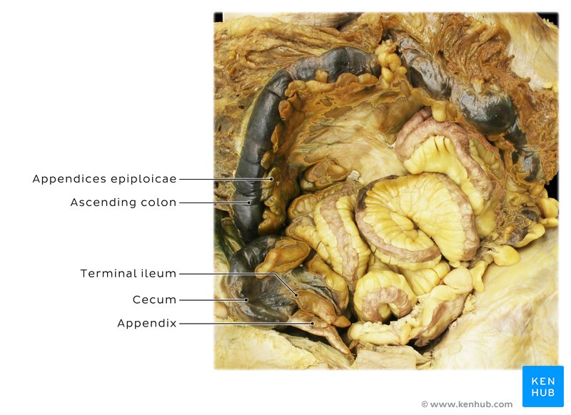 Cecum, appendix and ascending colon in a cadaver