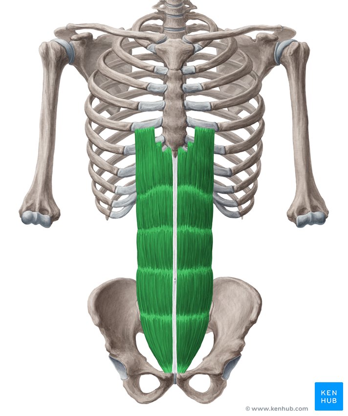 Upper discount rectus abdominis