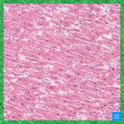 Textus muscularis cardiacus (Herzmuskel); Bild: 
