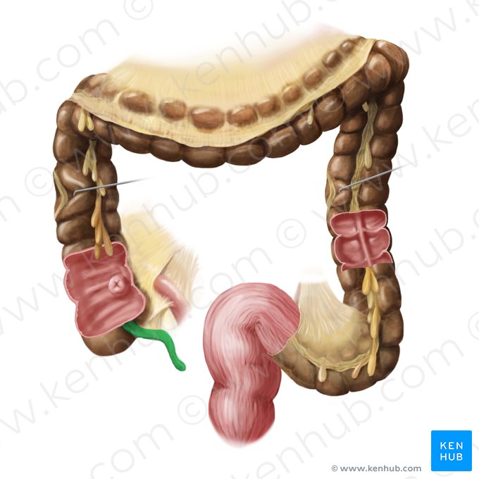 Apéndice vermiforme (Appendix vermiformis); Imagen: Begoña Rodriguez