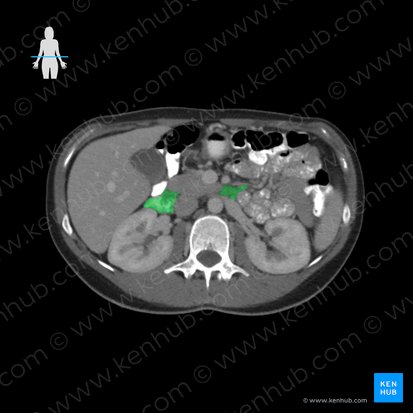 Duodeno (Duodenum); Imagen: 