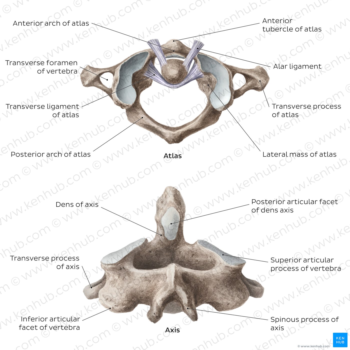 Superior view of atlas (C1), posterior view of axis (C2)