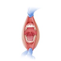 Oral cavity