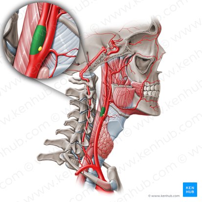 Carotid sinus (Sinus carotidis); Image: Paul Kim