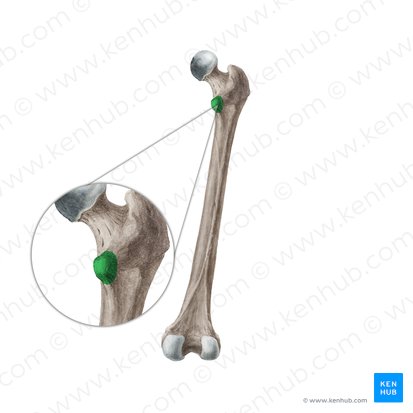 Lesser trochanter of femur (Trochanter minor ossis femoris); Image: Liene Znotina