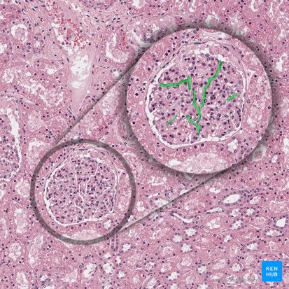 Endothelium fenestratum glomerulare (Fenestriertes Kapillarendothel); Bild: 