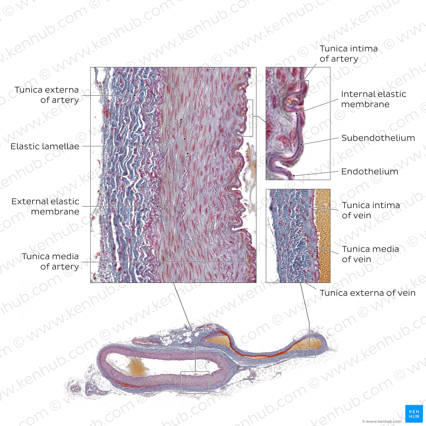 Artery and vein 