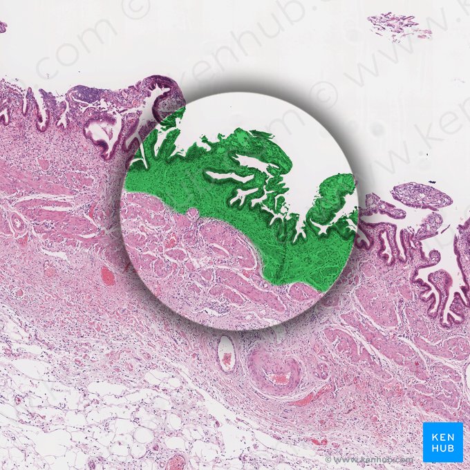 Mucosa (Tunica mucosa); Imagen: 