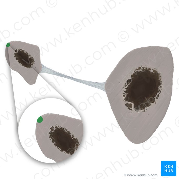 Borda posterior da fíbula (Margo posterior fibulae); Imagem: Tal Bavli Ziv