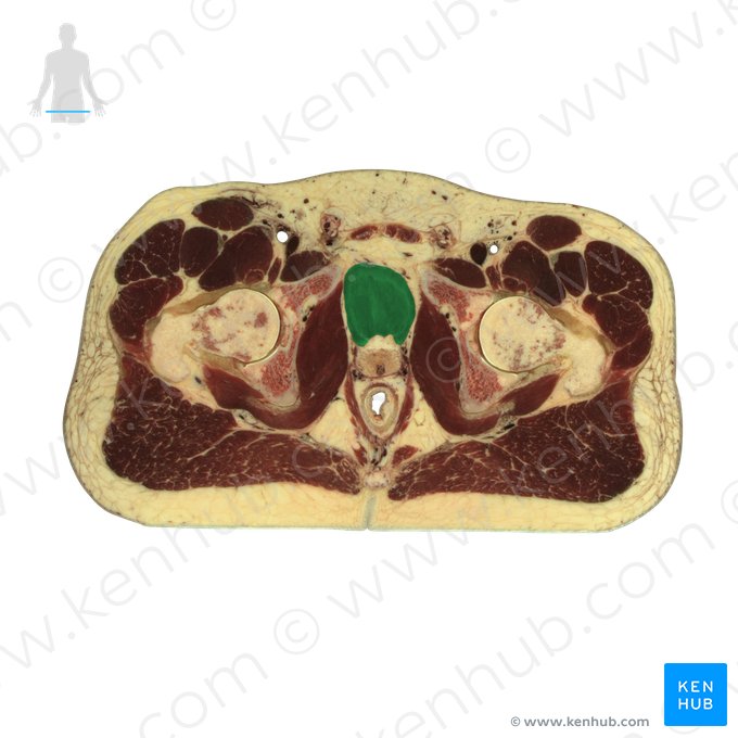 Urinary bladder (Vesica urinaria); Image: National Library of Medicine