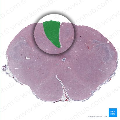 Gracile nucleus (Nucleus gracilis); Image: 