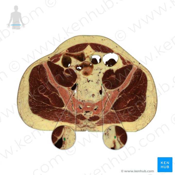Ureter (Harnleiter); Bild: National Library of Medicine