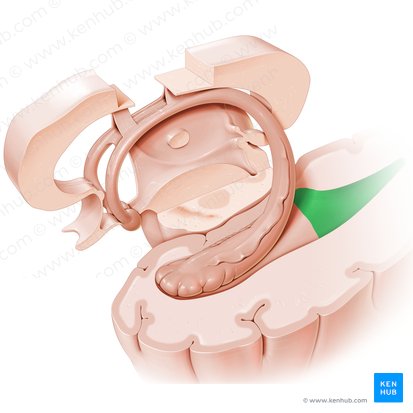 Occipital horn of lateral ventricle (Cornu occipitale ventriculi lateralis); Image: Paul Kim