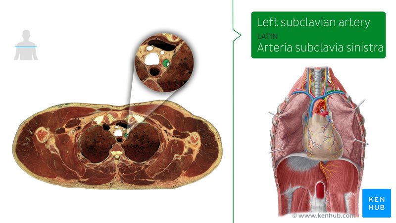 Subclavian artery in cross section