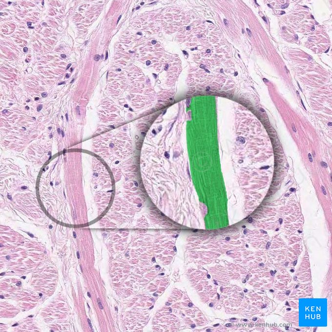 Sarcoplasm (Sarcoplasma); Image: 