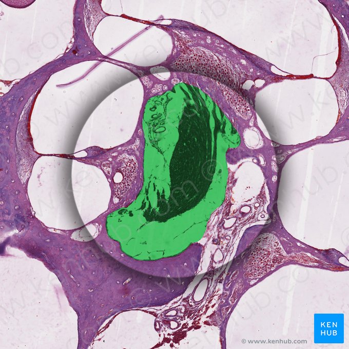 Modiolo (Modiolus cochleae); Imagen: 