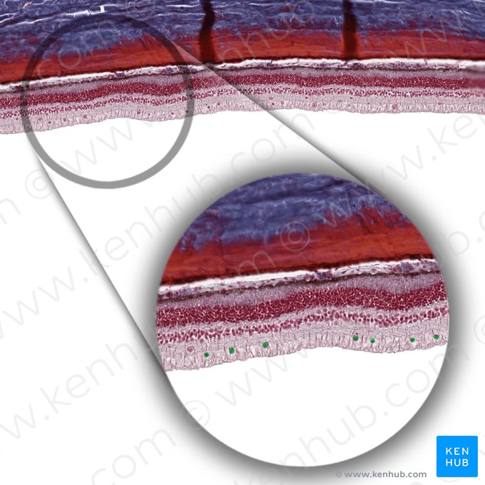 Célula ganglionar de la retina (Neuron ganglionare multipolare retinae); Imagen: 