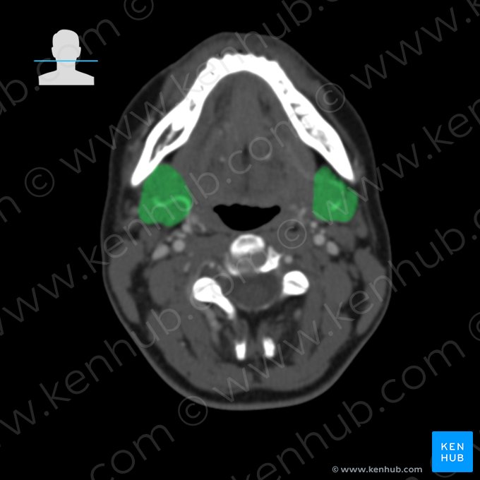 Glande submandibulaire (Glandula submandibularis); Image : 