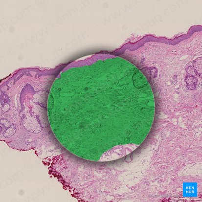 Derme (Dermis); Image : 