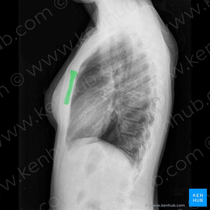 Cuerpo del esternón (Corpus sterni); Imagen: 