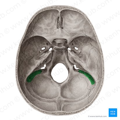 Sulcus sinus sigmoidei ossis temporalis (Furche des s-förmigen Blutleiters); Bild: Yousun Koh