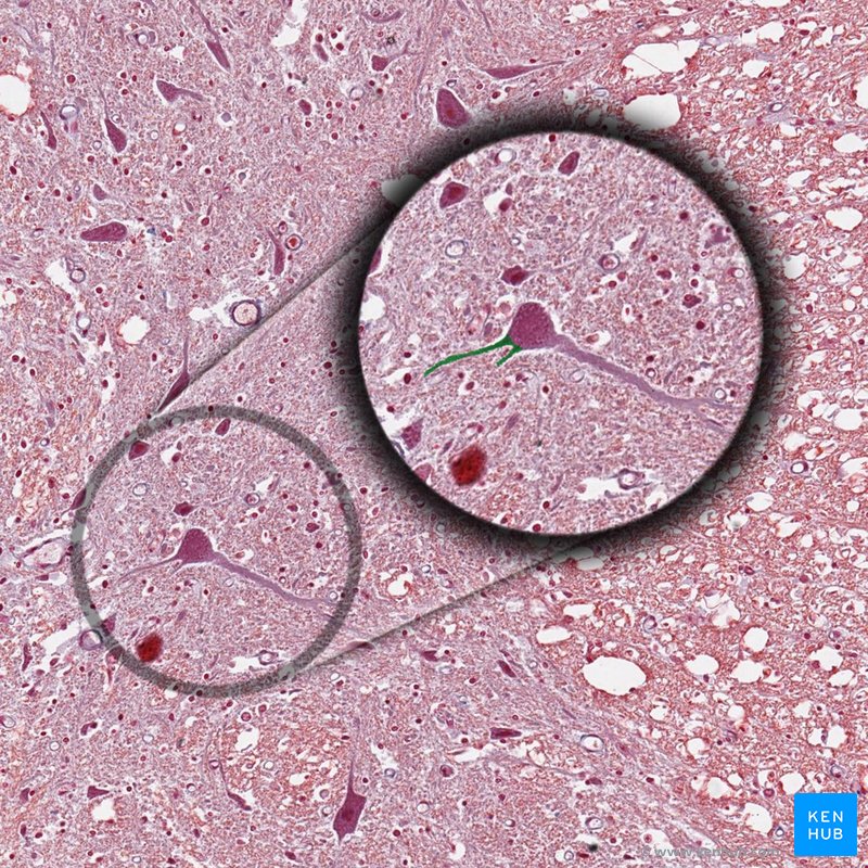 Dendrites - histological slide