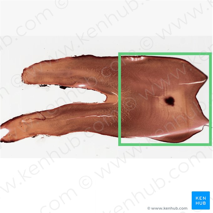 Crown of tooth (Corona dentis); Image: 