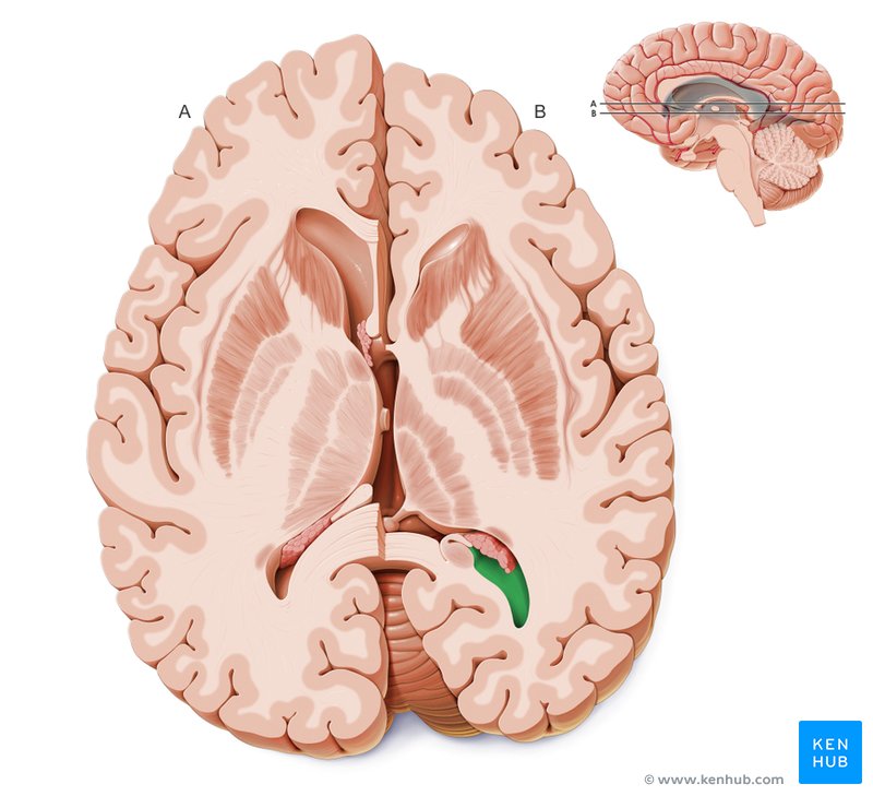 Posterior horn of the lateral ventricle - cross-sectional view