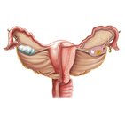 Uterus und Ovarien
