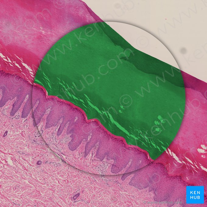 Stratum corneum of epidermis (Stratum corneum epidermis); Image: 